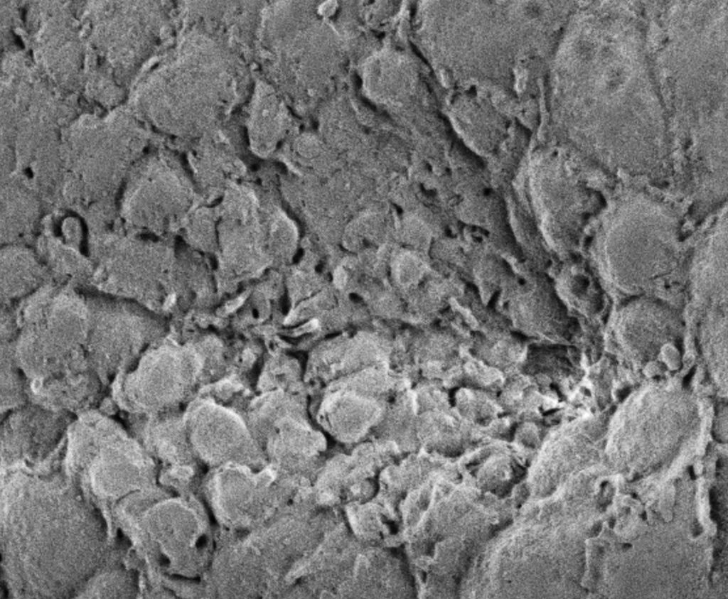 Salivary gland and trachea morphogenesis